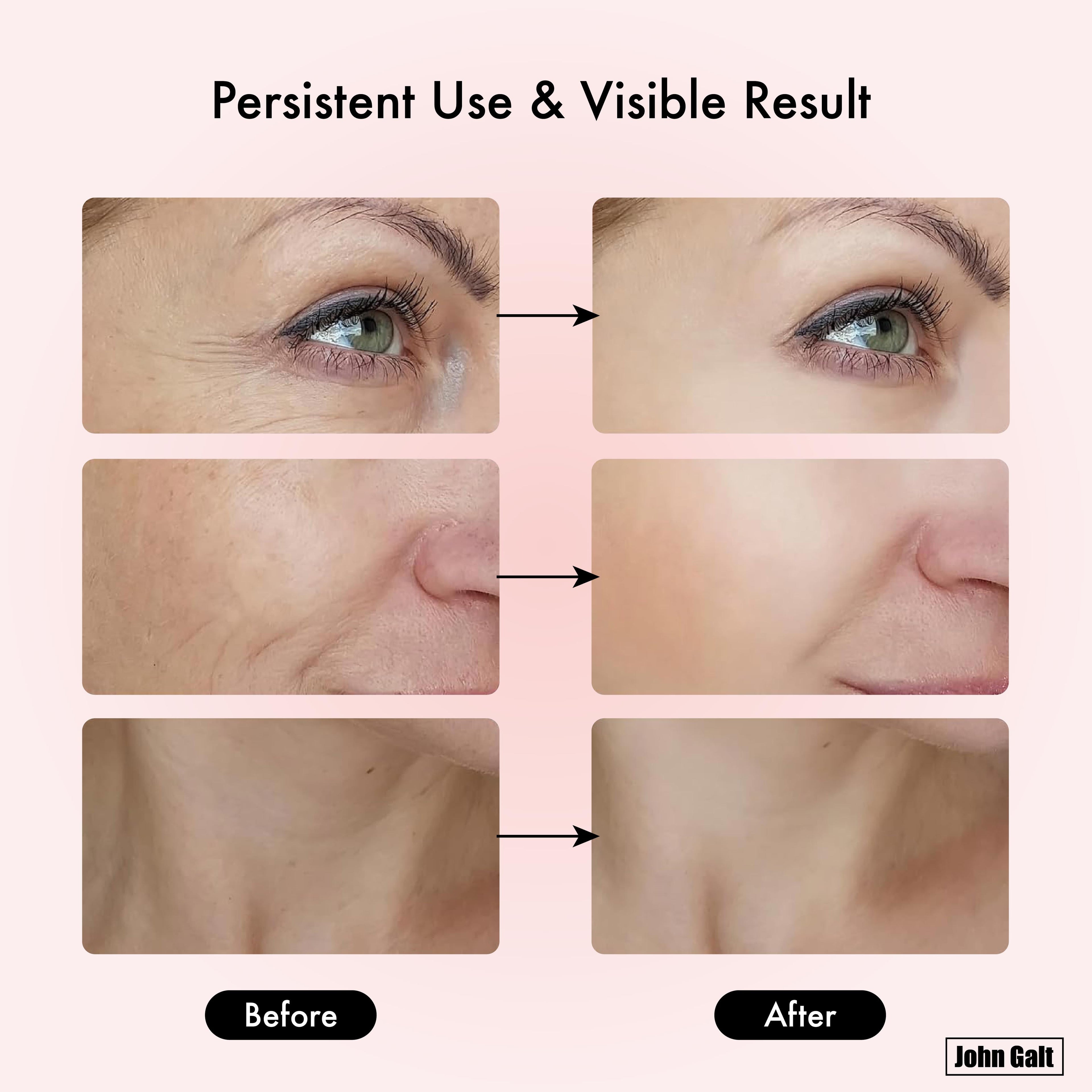 Red Light Therapy Massager for Face and Neck, 7 Color Led W/ Skin Care - Black